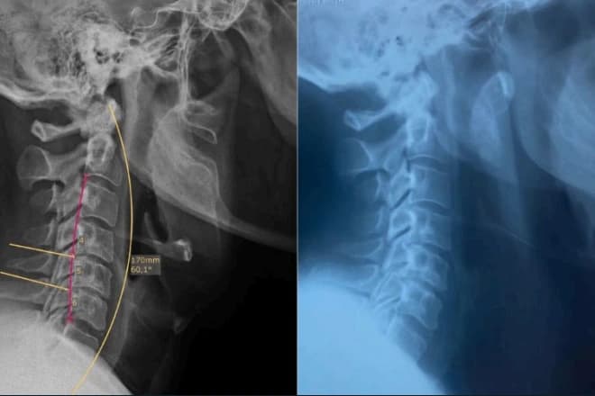 Comparison montage of radiographic images from Daniel Stanford’s personal medical history.